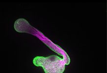 Biology: Membrane building blocks play decisive role in controlling cell growth