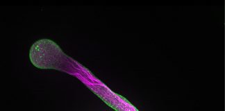 Biology: Membrane building blocks play decisive role in controlling cell growth