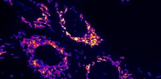 Biology: Parkinson’s disease: When molecular guardians need to be protected