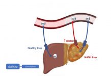 Biology: Protein controlling magnesium identified as therapeutic target for non-alcoholic fatty liver disease