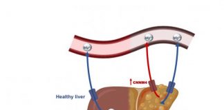Biology: Protein controlling magnesium identified as therapeutic target for non-alcoholic fatty liver disease