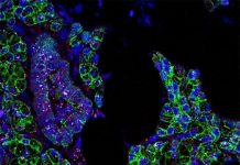 Biology: Researchers find evidence that novel coronavirus invades the mouth’s cells