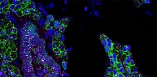 Biology: Researchers find evidence that novel coronavirus invades the mouth’s cells