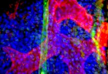 Biology: Single cell sequencing opens new avenues for eradicating leukemia at its source