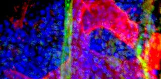 Biology: Single cell sequencing opens new avenues for eradicating leukemia at its source