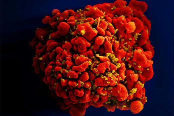 Scientists devise more efficient, enduring CAR gene therapy to combat HIV