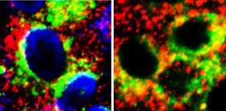 Research reveals potential new treatment target in the fight against COVID-19 Research reveals potential new treatment target in the fight against COVID-19