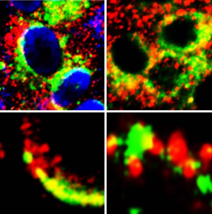 Research reveals potential new treatment target in the fight against COVID-19