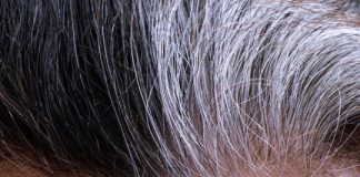 Research: Stress can turn hair gray — and it’s reversible Research: Stress can turn hair gray -- and it's reversible