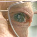 Implanted telescope restores sight to macular degeneration patients Implanted telescope restores sight to macular degeneration patients