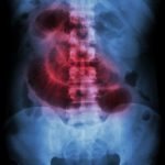 Research: Immune system keeps the intestinal flora in balance Research: Immune system keeps the intestinal flora in balance