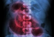 Research: Immune system keeps the intestinal flora in balance Research: Immune system keeps the intestinal flora in balance