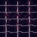 Researchers show how AI may spot unseen signs of heart failure Researchers show how AI may spot unseen signs of heart failure