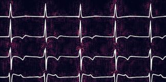 Researchers show how AI may spot unseen signs of heart failure Researchers show how AI may spot unseen signs of heart failure