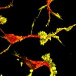 Researchers discover biological mechanisms caused by deficits in high-risk autism gene Researchers discover biological mechanisms caused by deficits in high-risk autism gene