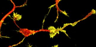 Researchers discover biological mechanisms caused by deficits in high-risk autism gene Researchers discover biological mechanisms caused by deficits in high-risk autism gene