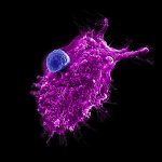 Researchers make strides toward an ‘off-the-shelf’ immune cell therapy for cancer Researchers make strides toward an ‘off-the-shelf’ immune cell therapy for cancer