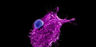 Researchers make strides toward an ‘off-the-shelf’ immune cell therapy for cancer Researchers make strides toward an ‘off-the-shelf’ immune cell therapy for cancer