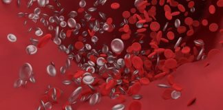 Researchers using nanoparticles to speed blood clot busting Researchers using nanoparticles to speed blood clot busting