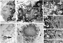 Study: The ultrastructure of huntingtin inclusions revealed Study: The ultrastructure of huntingtin inclusions revealed