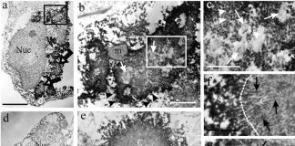 Study: The ultrastructure of huntingtin inclusions revealed Study: The ultrastructure of huntingtin inclusions revealed