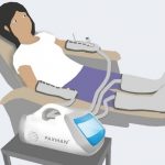 Research: Paxman KTP to create new device to prevent chemotherapy side-effect CIPN Research- Paxman KTP to create new device to prevent chemotherapy side-effect CIPN