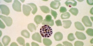 Research points to novel method of detecting complications caused by P. vivax in malaria patients Research points to novel method of detecting complications caused by P. vivax in malaria patients