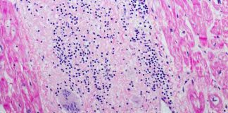 Sarcoidosis suffers hear it all the time: ‘You don’t look sick!’ Sarcoidosis suffers hear it all the time: ‘You don’t look sick!’