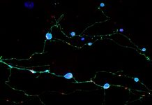 Scripps study discovery illuminates how brain cells die in prion diseases Scripps study discovery illuminates how brain cells die in prion diseases