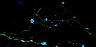 Scripps study discovery illuminates how brain cells die in prion diseases Scripps study discovery illuminates how brain cells die in prion diseases