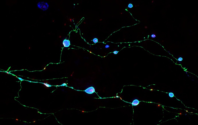 Scripps study discovery illuminates how brain cells die in prion diseases Scripps study discovery illuminates how brain cells die in prion diseases