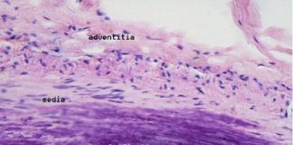 Nanoparticles developed to repair arteries, preventing heart attacks and strokes Nanoparticles developed to repair arteries, preventing heart attacks and strokes
