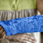 Research: Metal pins no better than traditional plaster cast for a broken wrist Research: Metal pins no better than traditional plaster cast for a broken wrist