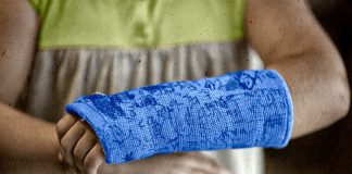 Research: Metal pins no better than traditional plaster cast for a broken wrist Research: Metal pins no better than traditional plaster cast for a broken wrist