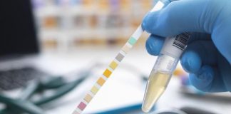 Color of urine is a good way to check hydration in kids Color of urine is a good way to check hydration in kids