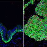 New UCLA research may lead to lung cancer prevention New UCLA research may lead to lung cancer prevention