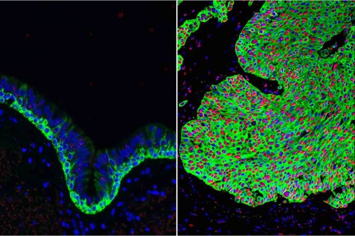 New UCLA research may lead to lung cancer prevention