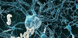 New research may lead to memory restoration in Alzheimer’s disease New research may lead to memory restoration in Alzheimer’s disease