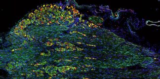 Researchers identify neural disruptions underlying feeding, swallowing disorders in children Researchers identify neural disruptions underlying feeding, swallowing disorders in children