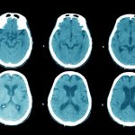 Your brain works differently during meditation Your brain works differently during meditation