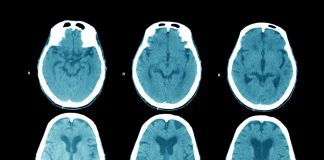Your brain works differently during meditation Your brain works differently during meditation