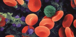 Aspirin may slow down the progression of emphysema Aspirin may slow down the progression of emphysema