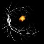 Researchers restore vision with human adult stem cells Researchers restore vision with human adult stem cells