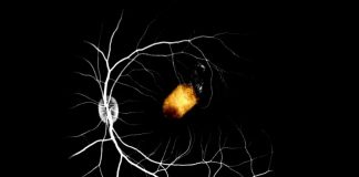 Researchers restore vision with human adult stem cells Researchers restore vision with human adult stem cells