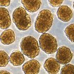 Stem cell research has brought a possible diabetes cure to within three years Stem cell research has brought a possible diabetes cure to within three years