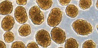 Stem cell research has brought a possible diabetes cure to within three years Stem cell research has brought a possible diabetes cure to within three years