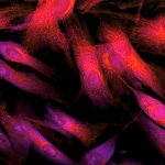 Study: Skin cell damage occurs even after you’ve taken cover from UV rays Study: Skin cell damage occurs even after you've taken cover from UV rays