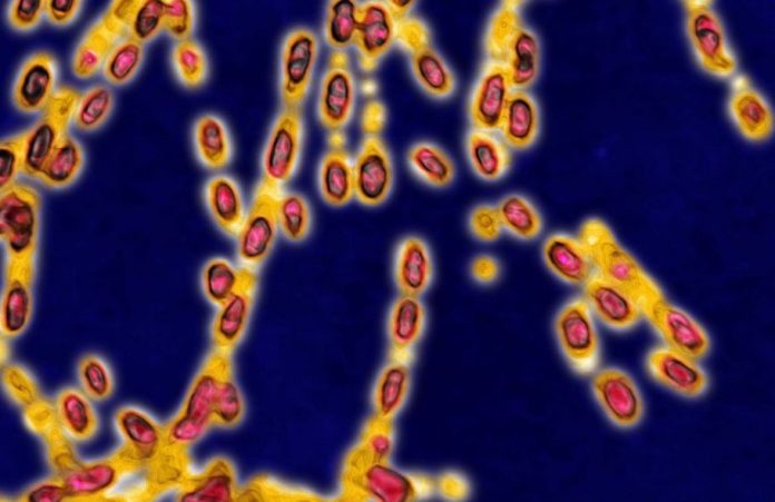 UCLA develops nanoparticle system to treat bioterrorism organism