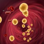 A byproduct of cholesterol fuels the growth and spread of common breast cancers A byproduct of cholesterol fuels the growth and spread of common breast cancers