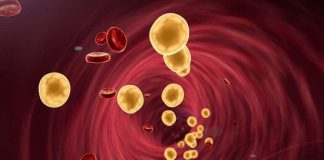A byproduct of cholesterol fuels the growth and spread of common breast cancers A byproduct of cholesterol fuels the growth and spread of common breast cancers